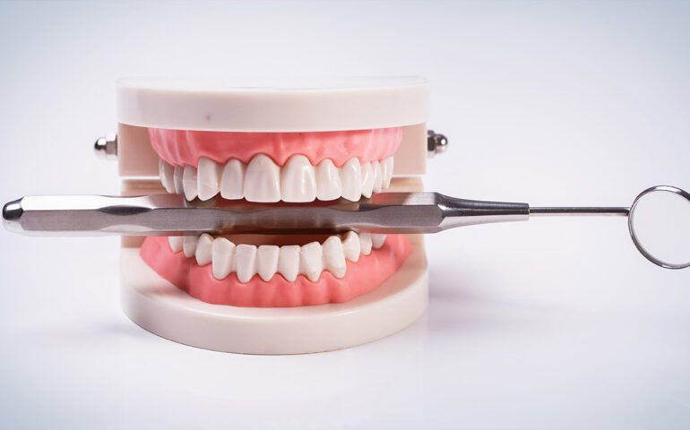 Dentures-Specialist-in-Gandhinagar