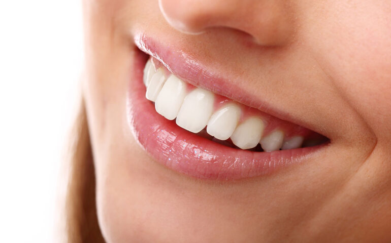 Gum Surgery in Ahmedabad