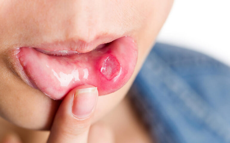 Oral Cancer Surgeons in Ahmedabad