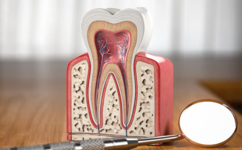 Root-Canal-Treatment-RCT-in-Gandhinagar
