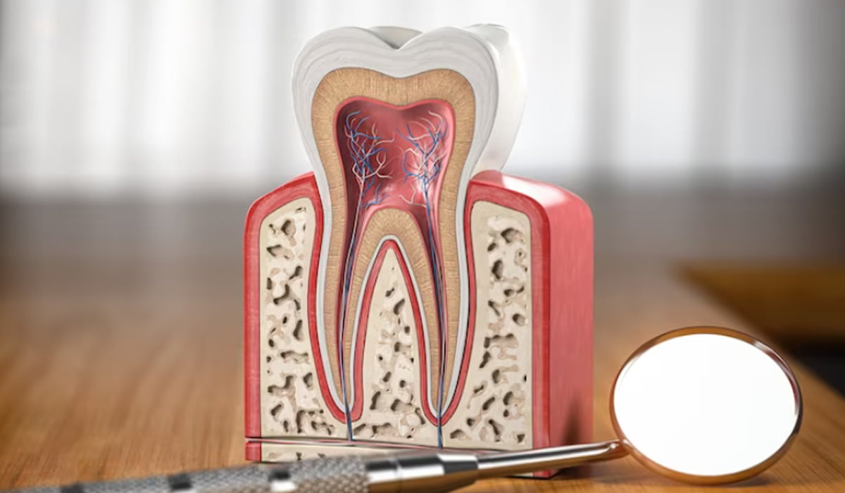 Root-Canal-Treatment-RCT-in-Gandhinagar