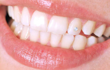 Teeth Jewellery